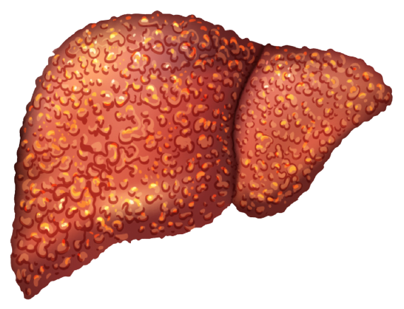 Liver cancer treatment centers in Chennai